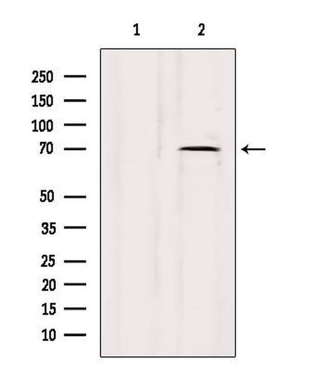 LMOD3 Antibody in Western Blot (WB)