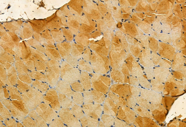 MPP5 Antibody in Immunohistochemistry (Paraffin) (IHC (P))