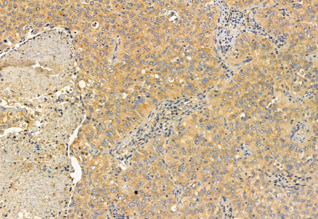 MPP5 Antibody in Immunohistochemistry (Paraffin) (IHC (P))