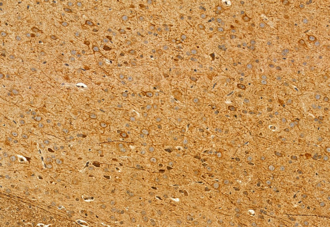 MPP5 Antibody in Immunohistochemistry (Paraffin) (IHC (P))