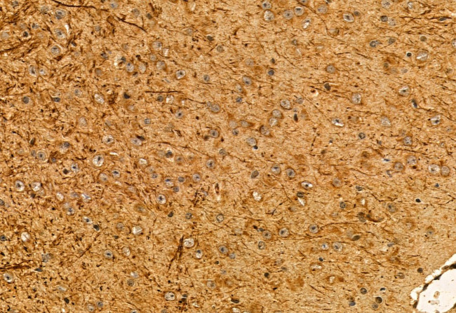 MPP5 Antibody in Immunohistochemistry (Paraffin) (IHC (P))