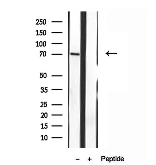 MPP5 Antibody in Western Blot (WB)