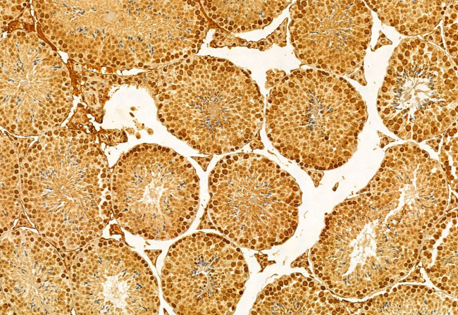 ODF2 Antibody in Immunohistochemistry (Paraffin) (IHC (P))