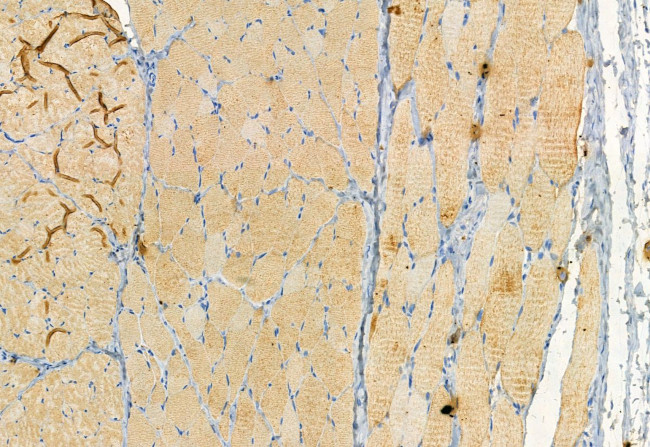 RAB27B Antibody in Immunohistochemistry (Paraffin) (IHC (P))