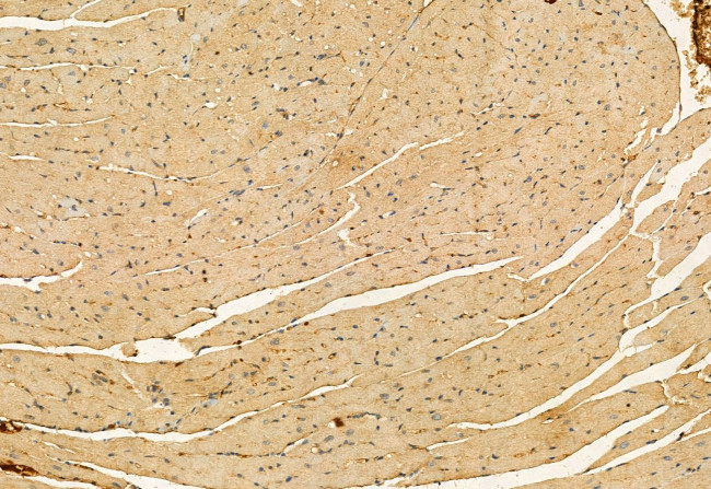 RAB27B Antibody in Immunohistochemistry (Paraffin) (IHC (P))