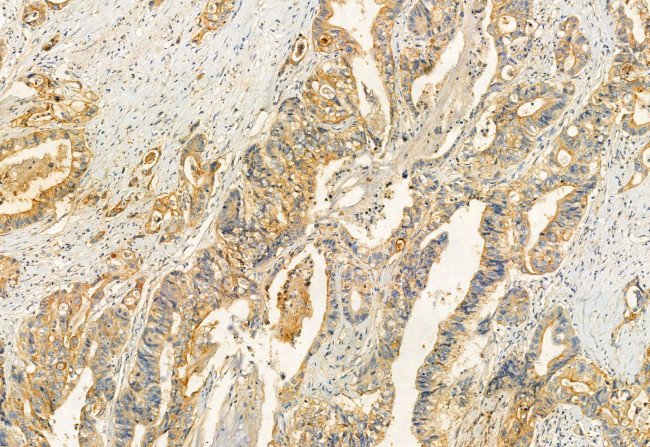 RAB27B Antibody in Immunohistochemistry (Paraffin) (IHC (P))