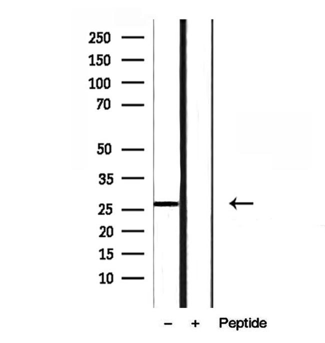 RAB27B Antibody in Western Blot (WB)