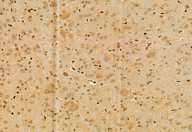 UBAP1 Antibody in Immunohistochemistry (Paraffin) (IHC (P))