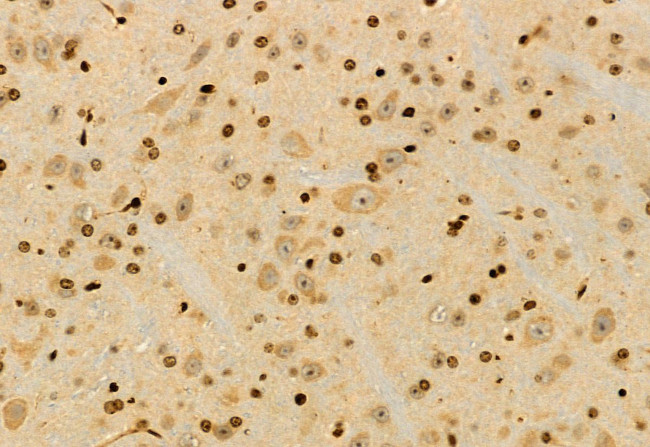 UBAP1 Antibody in Immunohistochemistry (Paraffin) (IHC (P))