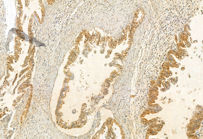 UBAP1 Antibody in Immunohistochemistry (Paraffin) (IHC (P))