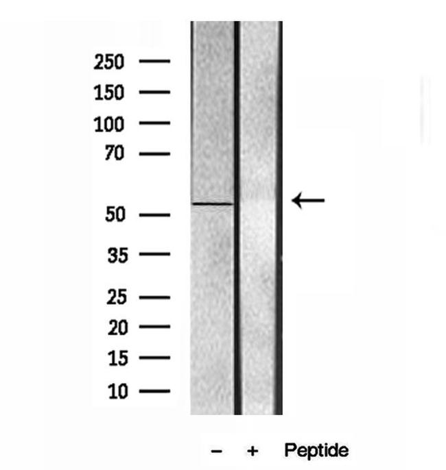 UBAP1 Antibody in Western Blot (WB)