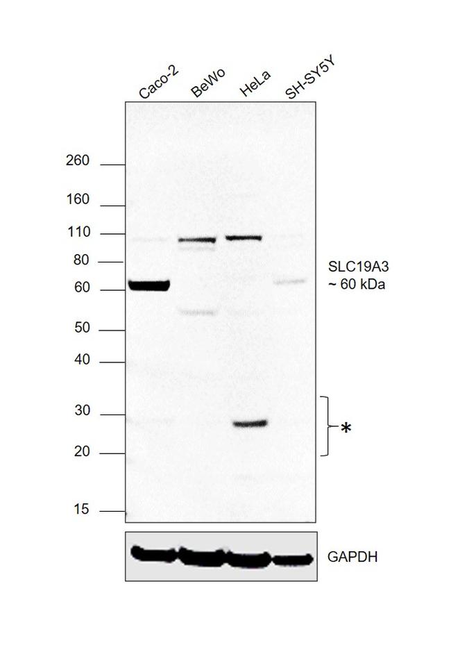 SLC19A3 Antibody in Western Blot (WB)