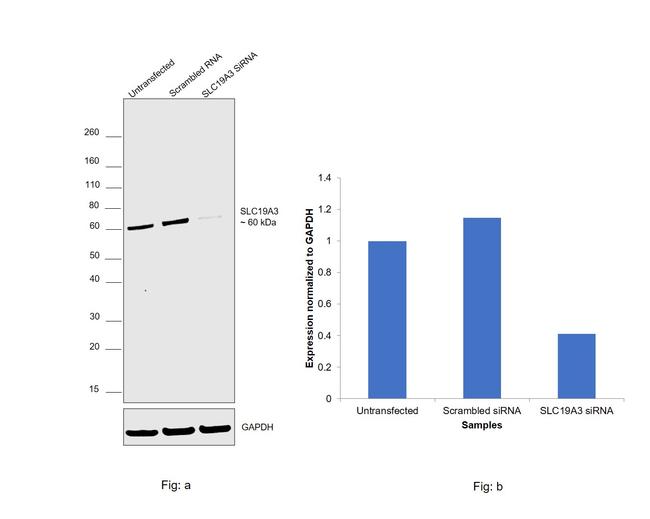 SLC19A3 Antibody in Western Blot (WB)