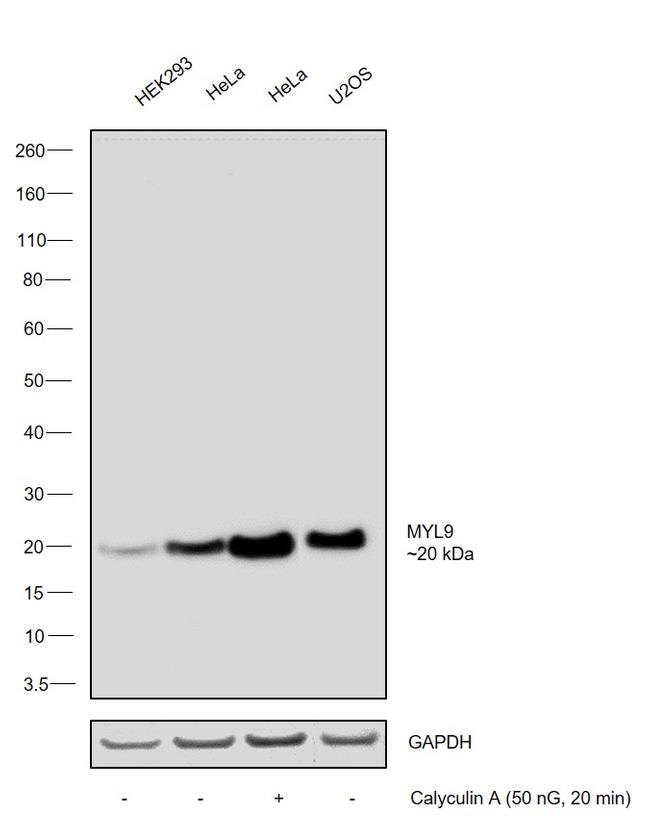 Phospho-MYL9 (Ser19) Antibody in Western Blot (WB)