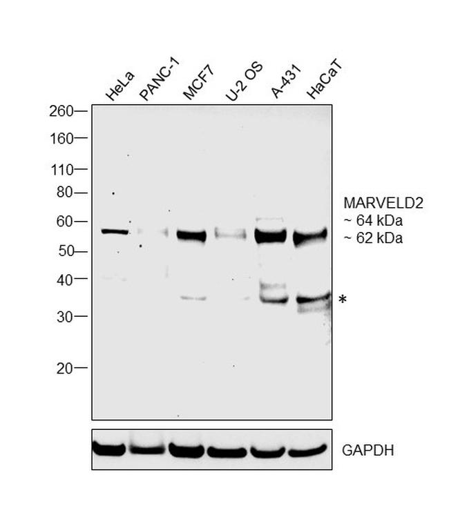 MARVELD2 Antibody in Western Blot (WB)