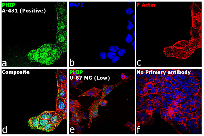 PHIP Antibody in Immunocytochemistry (ICC/IF)