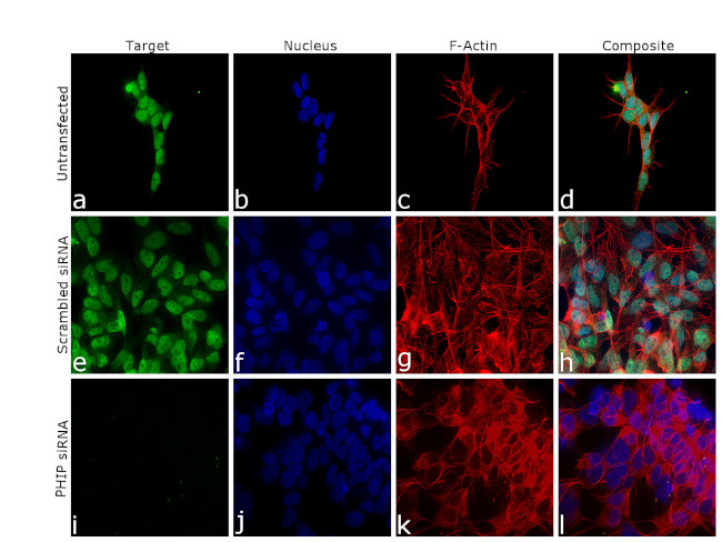 PHIP Antibody