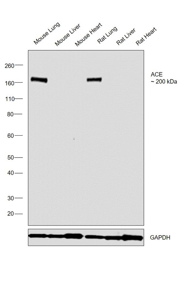 ACE Antibody in Western Blot (WB)