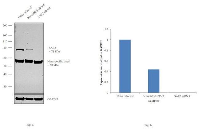 UBA2 Antibody in Western Blot (WB)