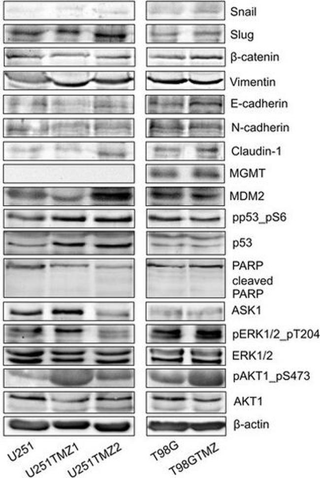 MDM2 Antibody in Western Blot (WB)