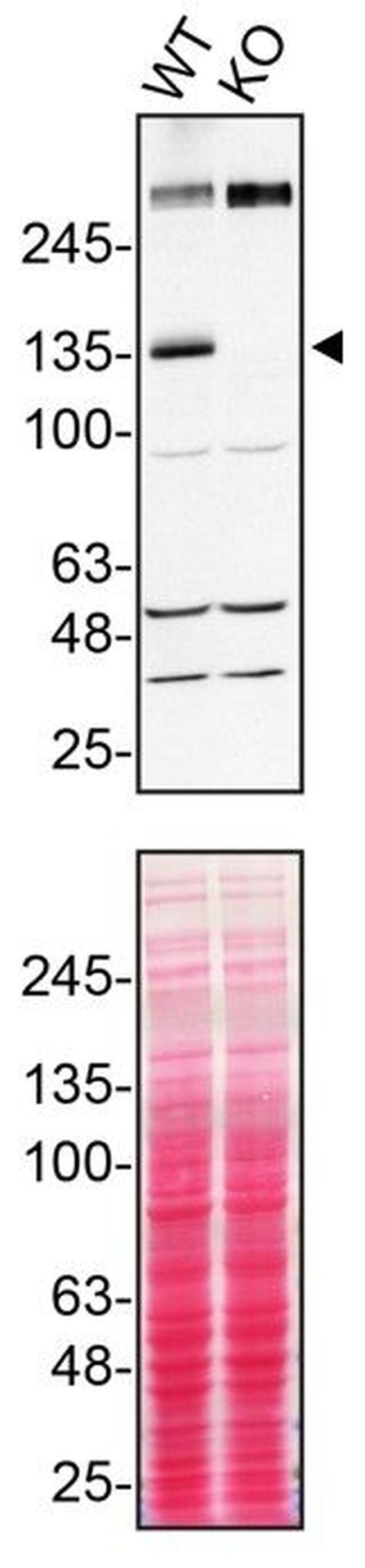 TSC1 Antibody in Western Blot (WB)