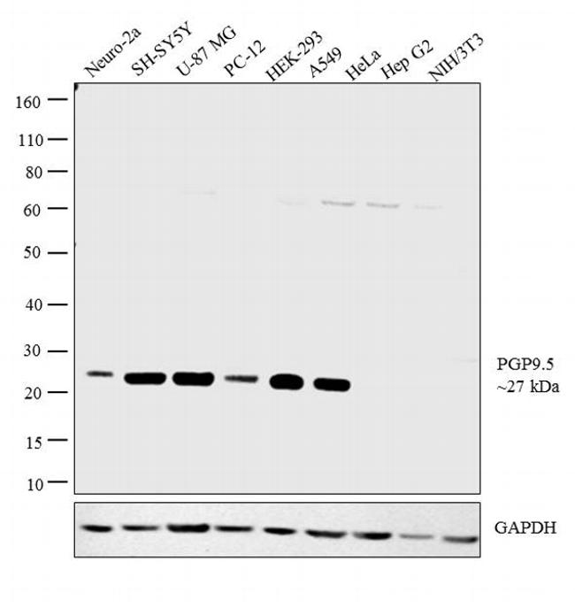 PGP9.5 Antibody in Western Blot (WB)