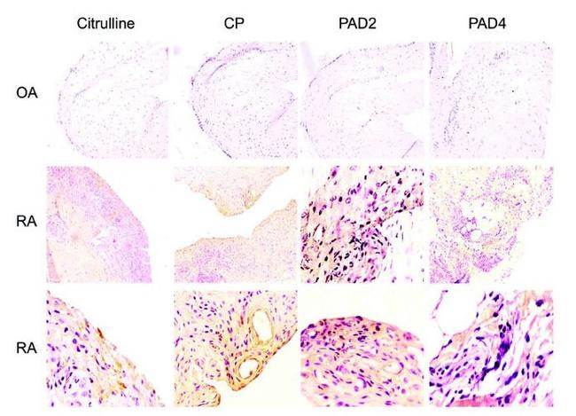 PADI4 Antibody in Immunohistochemistry (Paraffin) (IHC (P))