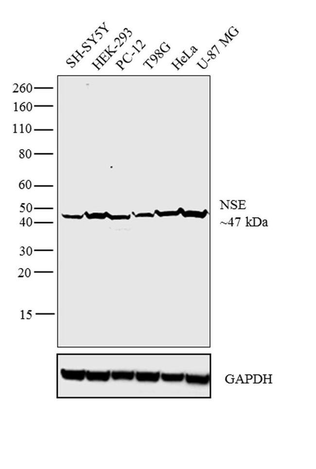 NSE Antibody in Western Blot (WB)