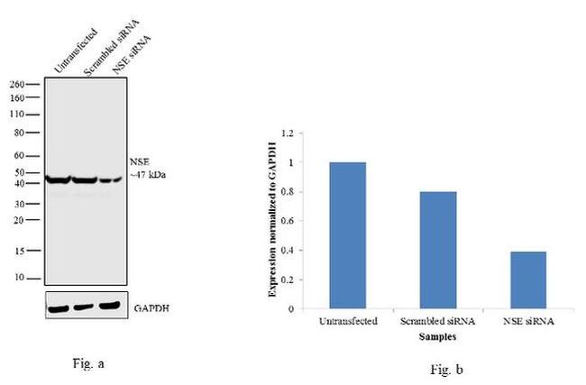 NSE Antibody in Western Blot (WB)