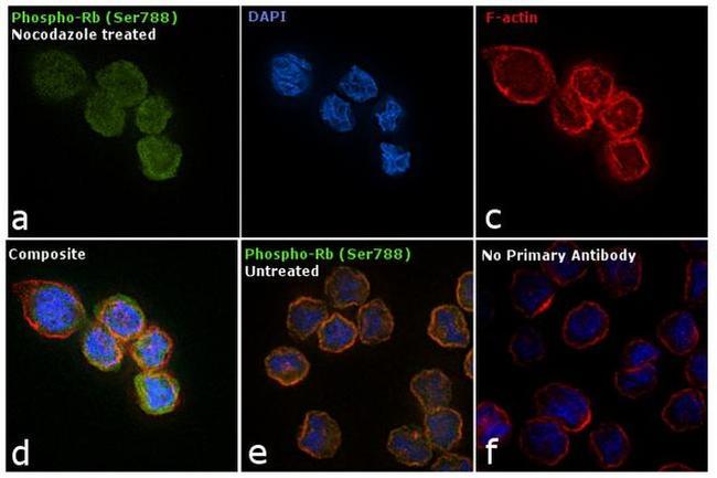 Phospho-Rb (Ser788) Antibody