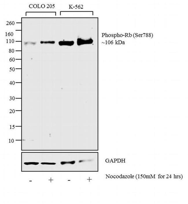 Phospho-Rb (Ser788) Antibody in Western Blot (WB)
