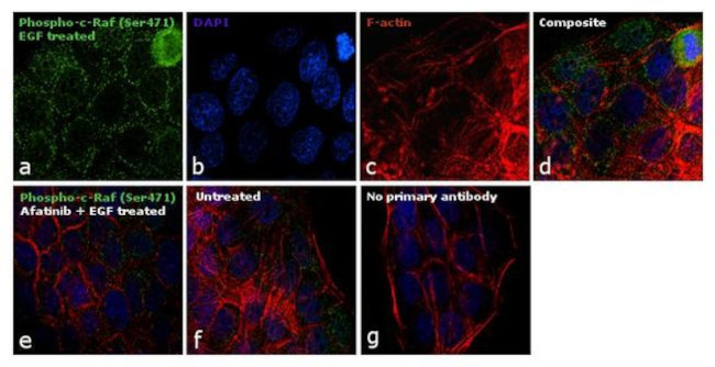 Phospho-c-Raf (Ser471) Antibody in Immunocytochemistry (ICC/IF)