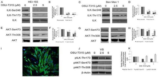 Phospho-ILK (Thr173) Antibody in Western Blot (WB)