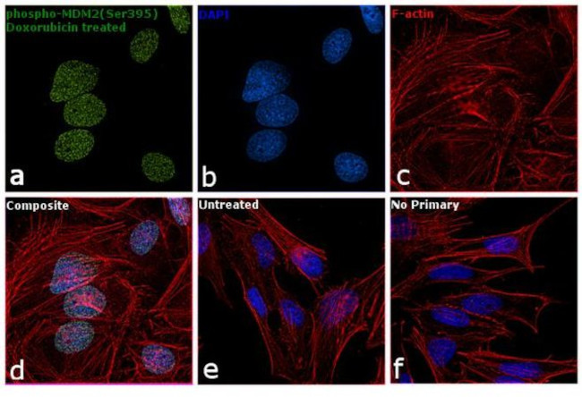 Phospho-MDM2 (Ser395) Antibody in Immunocytochemistry (ICC/IF)