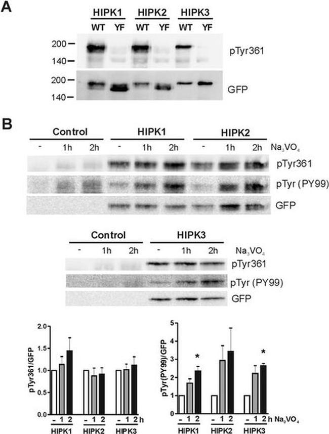 Phospho-HIPK2 (Tyr361) Antibody in Western Blot (WB)