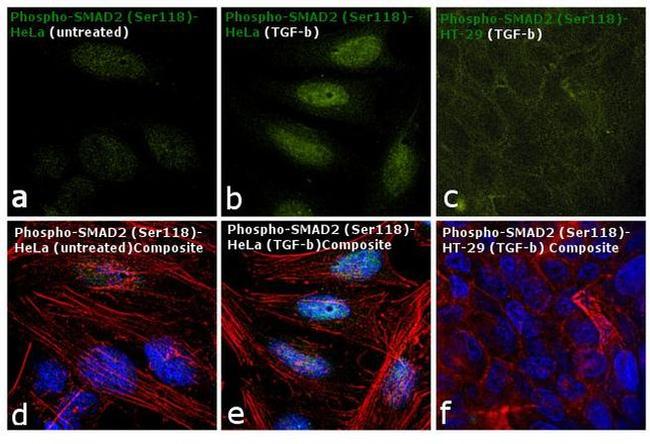 Phospho-SMAD2 (Ser118) Antibody