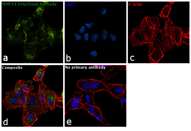 MMP14 Antibody in Immunocytochemistry (ICC/IF)