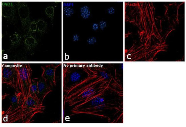 ENO1 Antibody in Immunocytochemistry (ICC/IF)