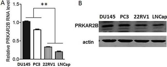 PRKAR2B Antibody in Western Blot (WB)