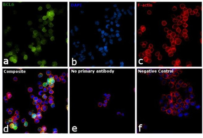 BCL6 Antibody in Immunocytochemistry (ICC/IF)