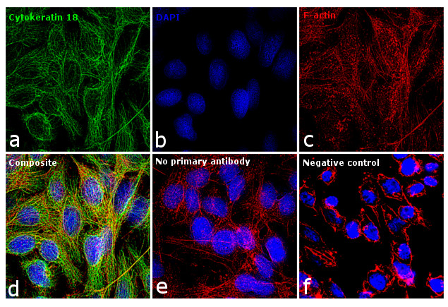 Cytokeratin 18 Antibody in Immunocytochemistry (ICC/IF)