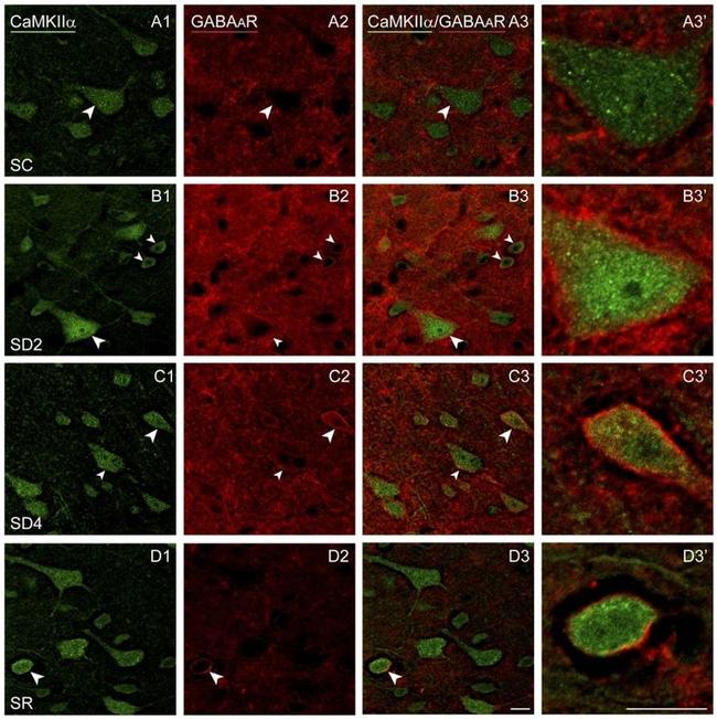 CaMKII alpha Antibody in Immunocytochemistry (ICC/IF)