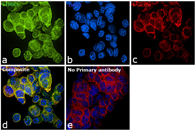 LIMK1 Antibody in Immunocytochemistry (ICC/IF)