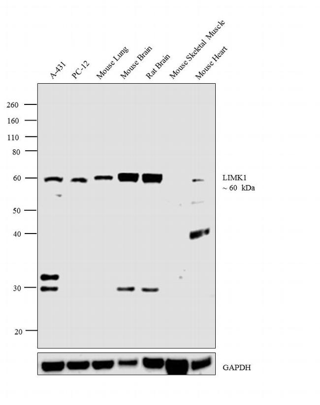 LIMK1 Antibody in Western Blot (WB)