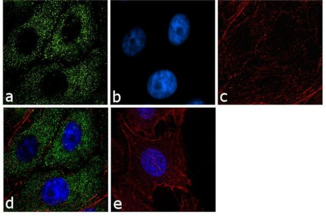 Laminin Antibody in Immunocytochemistry (ICC/IF)