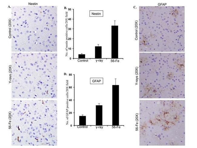 GFAP Antibody in Immunohistochemistry (IHC)