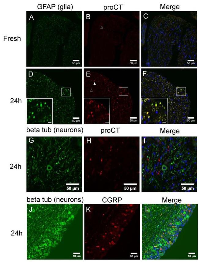 GFAP Antibody in Immunohistochemistry (IHC)