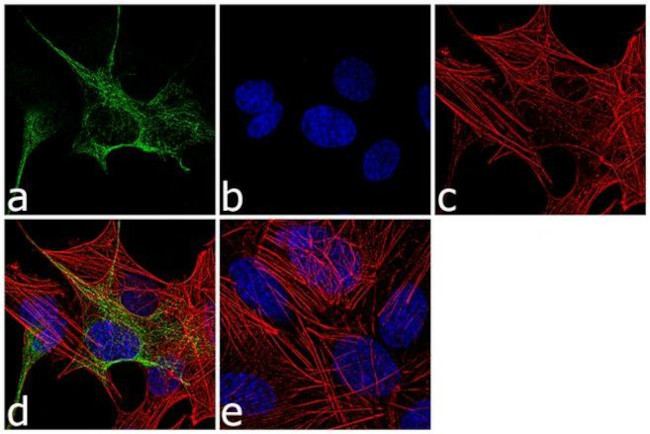 GFAP Antibody in Immunocytochemistry (ICC/IF)