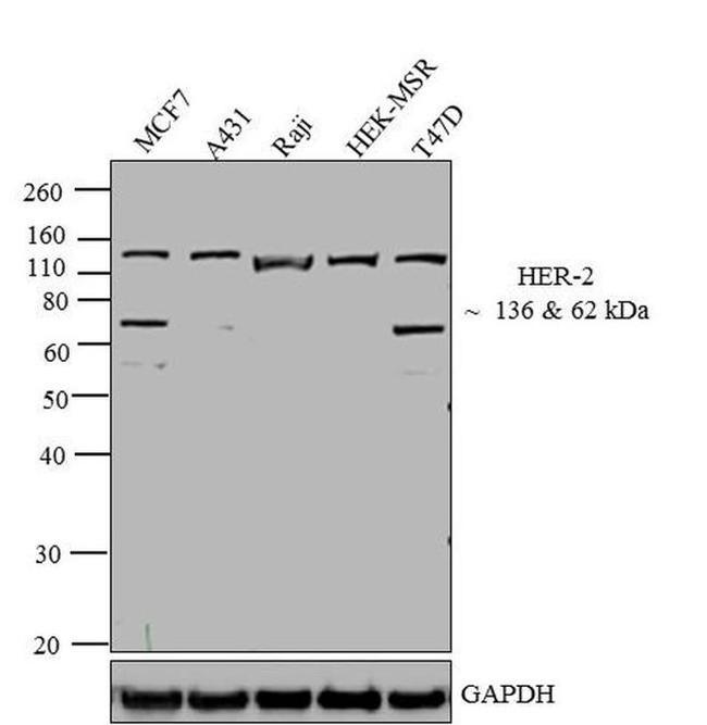 ErbB2 (HER-2) Antibody in Western Blot (WB)