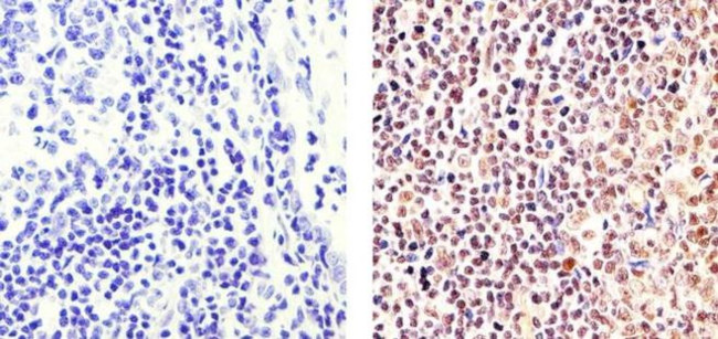 PARP1 Antibody in Immunohistochemistry (Paraffin) (IHC (P))